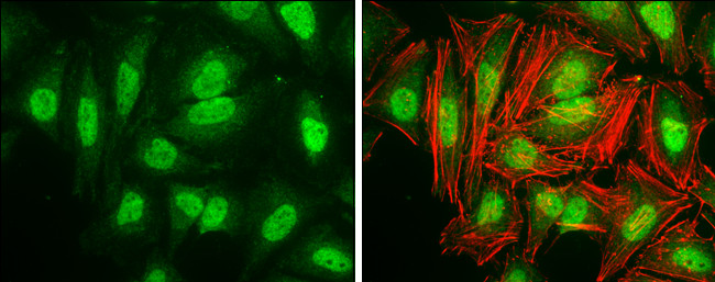 Cyclin D3 Antibody in Immunocytochemistry (ICC/IF)