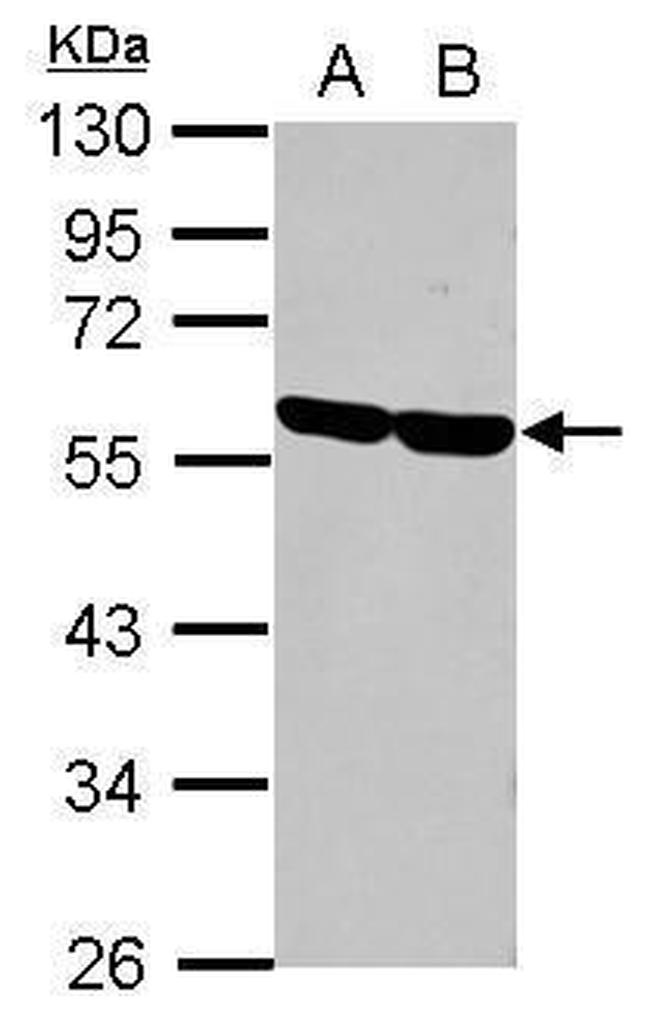 CD2 Antibody in Western Blot (WB)