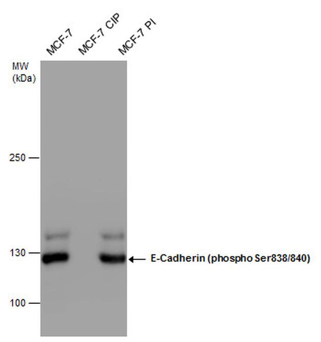 Phospho-E-cadherin (Ser838, Ser840) Antibody in Western Blot (WB)