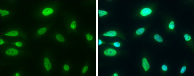 CHD3 Antibody in Immunocytochemistry (ICC/IF)