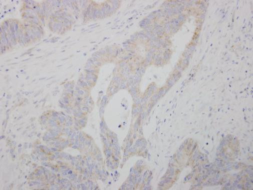 COMT Antibody in Immunohistochemistry (Paraffin) (IHC (P))