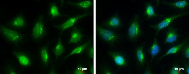CK1 alpha Antibody in Immunocytochemistry (ICC/IF)
