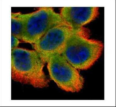 Cystatin B Antibody in Immunocytochemistry (ICC/IF)