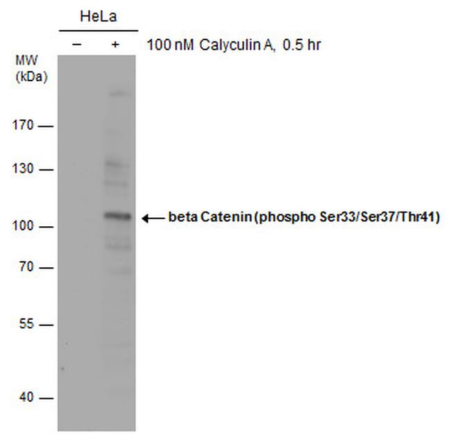 Phospho-beta Catenin (Ser33, Ser37, Thr41) Antibody in Western Blot (WB)