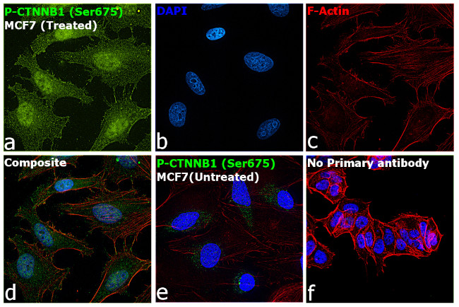Phospho-beta Catenin (Ser675) Antibody in Immunocytochemistry (ICC/IF)