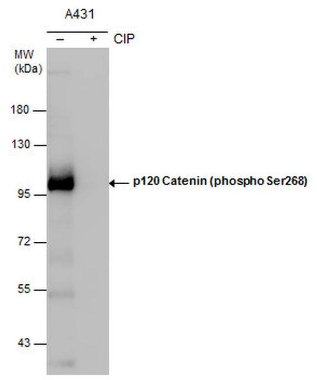 Phospho-delta Catenin (Ser268) Antibody in Western Blot (WB)