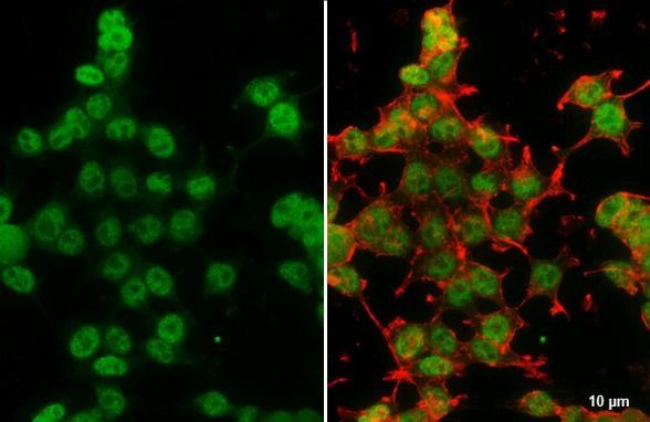 DNMT3A Antibody in Immunocytochemistry (ICC/IF)
