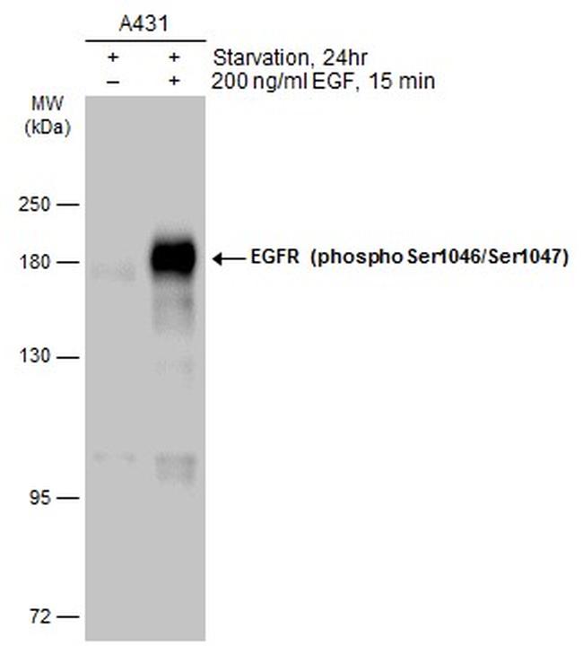 Phospho-EGFR (Ser1046, Ser1047) Antibody in Western Blot (WB)
