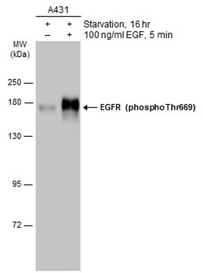 Phospho-EGFR (Thr669) Antibody in Western Blot (WB)