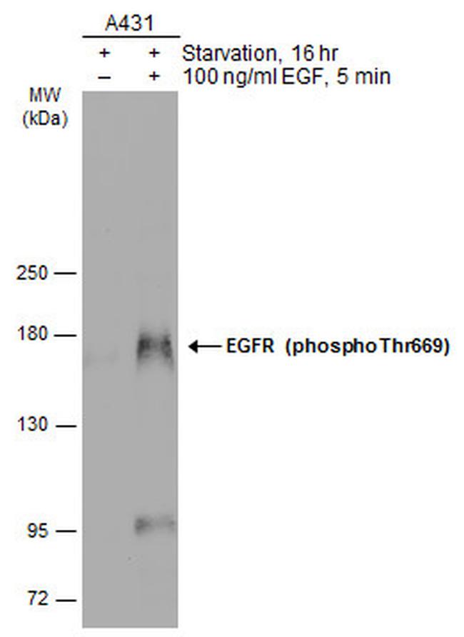 Phospho-EGFR (Thr669) Antibody in Western Blot (WB)