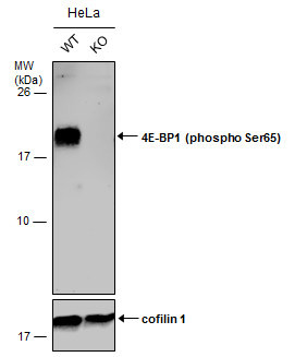 Phospho-4EBP1 (Ser65) Antibody in Western Blot (WB)