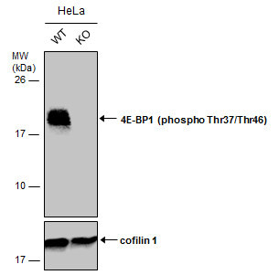 Phospho-4EBP1 (Thr37, Thr46) Antibody in Western Blot (WB)