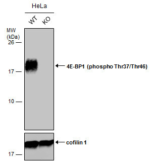 Phospho-4EBP1 (Thr37, Thr46) Antibody in Western Blot (WB)