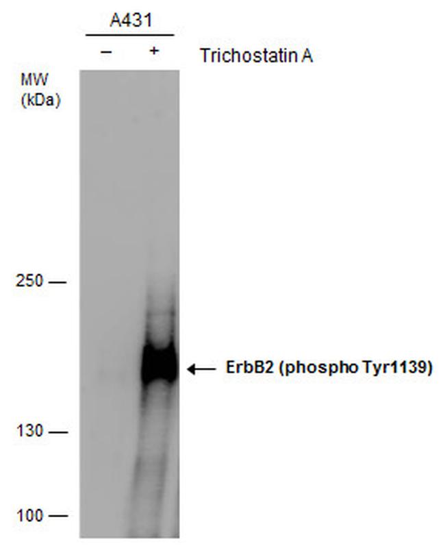 Phospho-ErbB2 (HER-2) (Tyr1139) Antibody in Western Blot (WB)