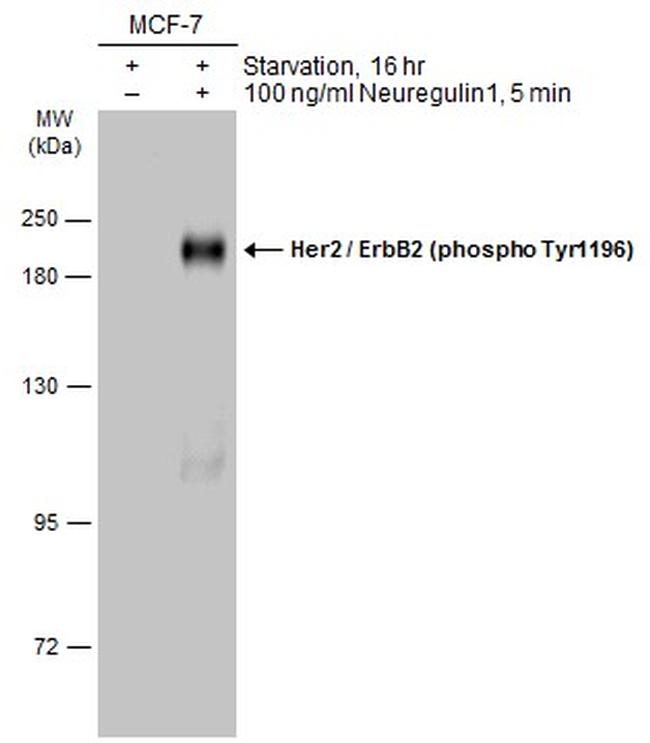 Phospho-ErbB2 (HER-2) (Tyr1196) Antibody in Western Blot (WB)