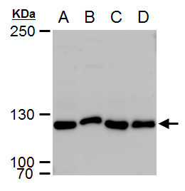XPF Antibody in Western Blot (WB)