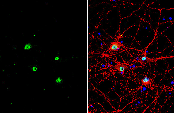 ETV1 Antibody in Immunocytochemistry (ICC/IF)