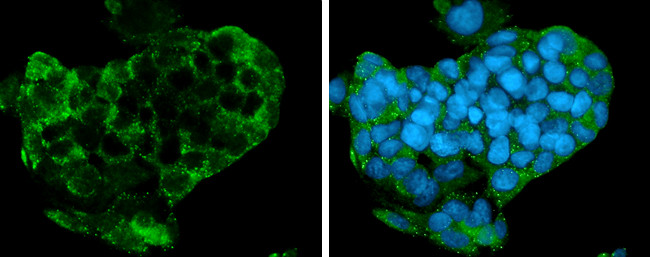 GPR15 Antibody in Immunocytochemistry (ICC/IF)