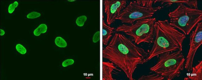 HDGF Antibody in Immunocytochemistry (ICC/IF)