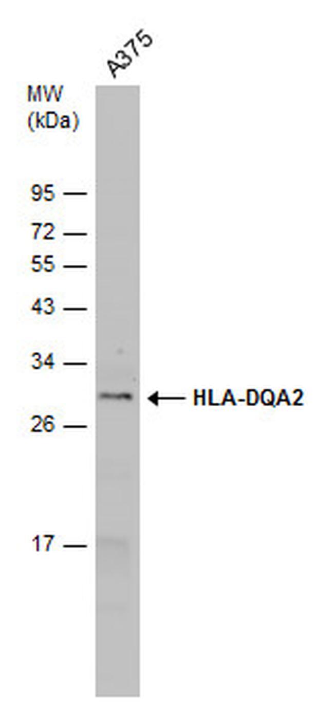 HLA-DQA2 Antibody in Western Blot (WB)