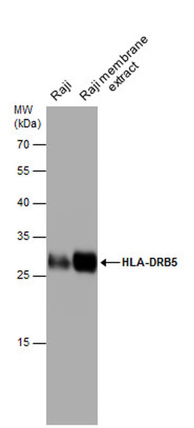 HLA-DRB5 Antibody in Western Blot (WB)