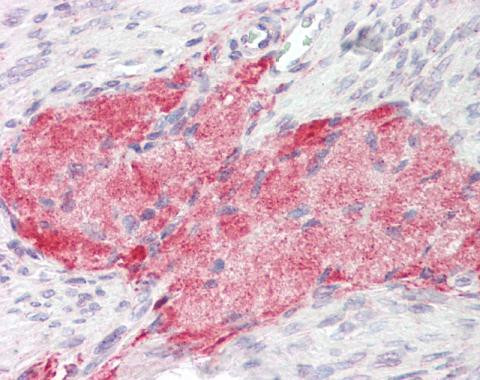 Tenascin C Antibody in Immunohistochemistry (Paraffin) (IHC (P))