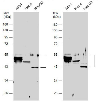 Cytokeratin 10 Antibody in Western Blot (WB)