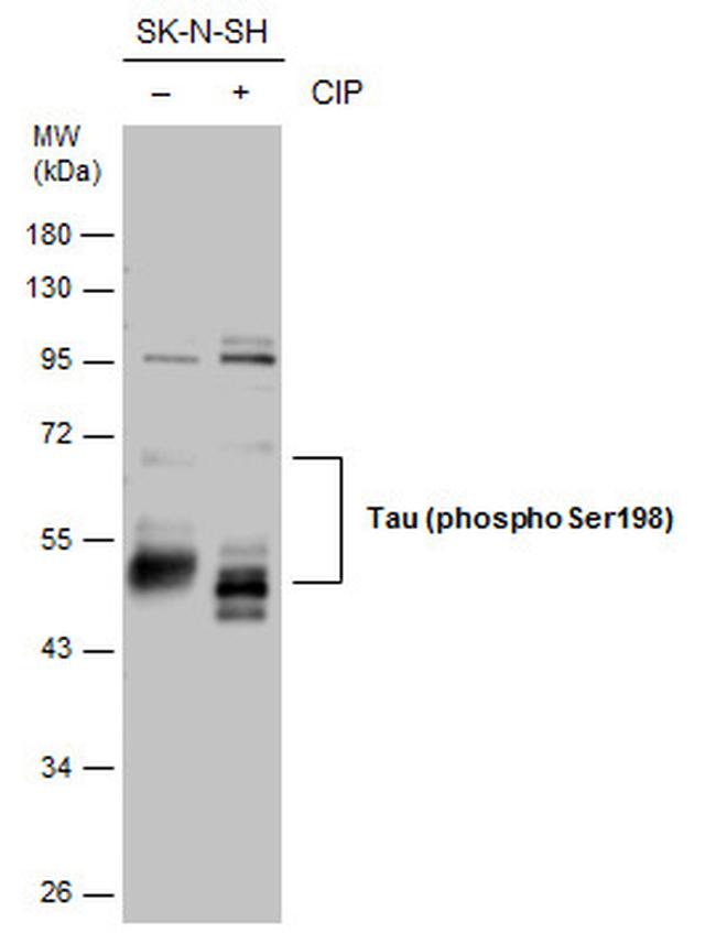 Phospho-Tau (Ser198) Antibody in Western Blot (WB)