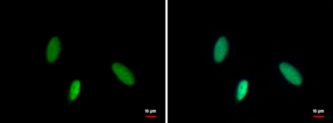 MCM6 Antibody in Immunocytochemistry (ICC/IF)