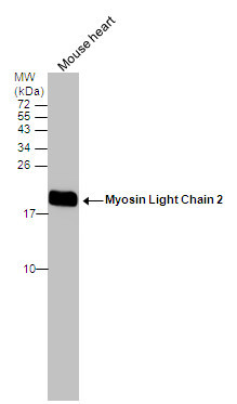 MYL2 Antibody in Western Blot (WB)