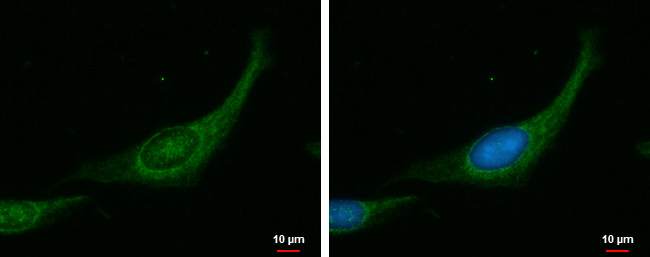 MYPT1 Antibody in Immunocytochemistry (ICC/IF)