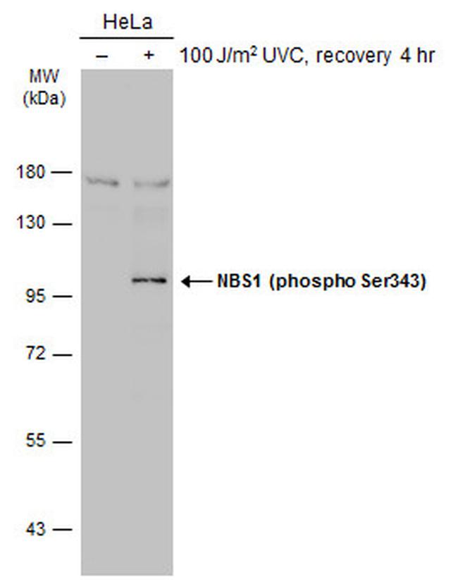 Phospho-NBS1 (Ser343) Antibody in Western Blot (WB)
