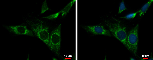 NDUFS3 Antibody in Immunocytochemistry (ICC/IF)