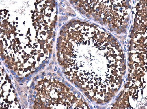 NSF Antibody in Immunohistochemistry (Paraffin) (IHC (P))