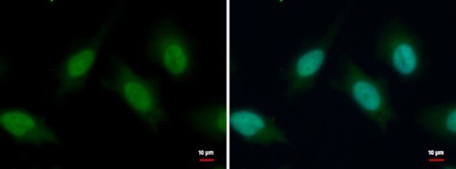 PBX3 Antibody in Immunocytochemistry (ICC/IF)