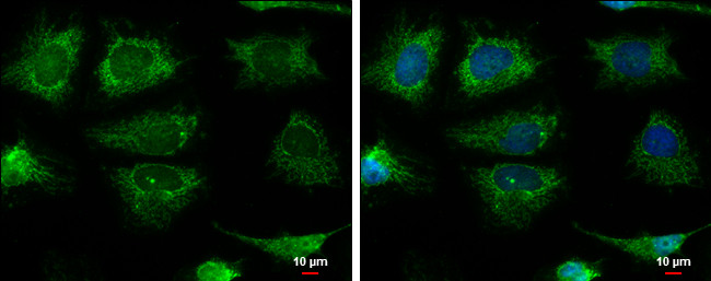 Pyruvate Carboxylase Antibody in Immunocytochemistry (ICC/IF)