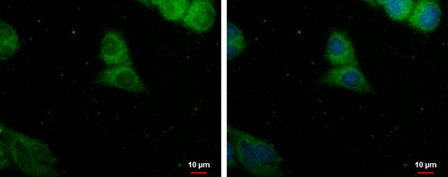 PDE8A Antibody in Immunocytochemistry (ICC/IF)