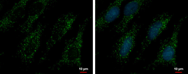 PEX14 Antibody in Immunocytochemistry (ICC/IF)