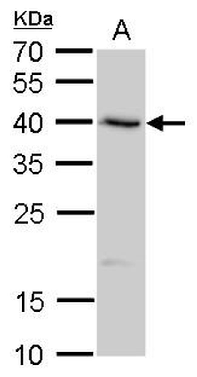SERPINB8 Antibody in Western Blot (WB)