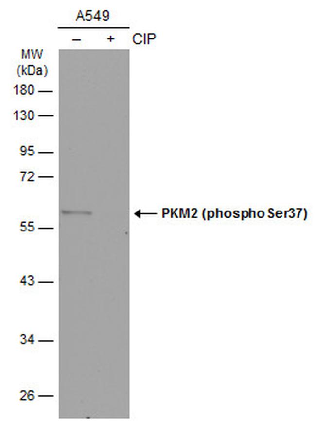 Phospho-PKM2 (Ser37) Antibody in Western Blot (WB)