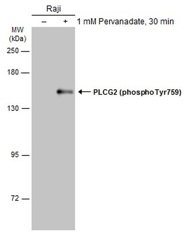 Phospho-PLCG2 (Tyr759) Antibody in Western Blot (WB)