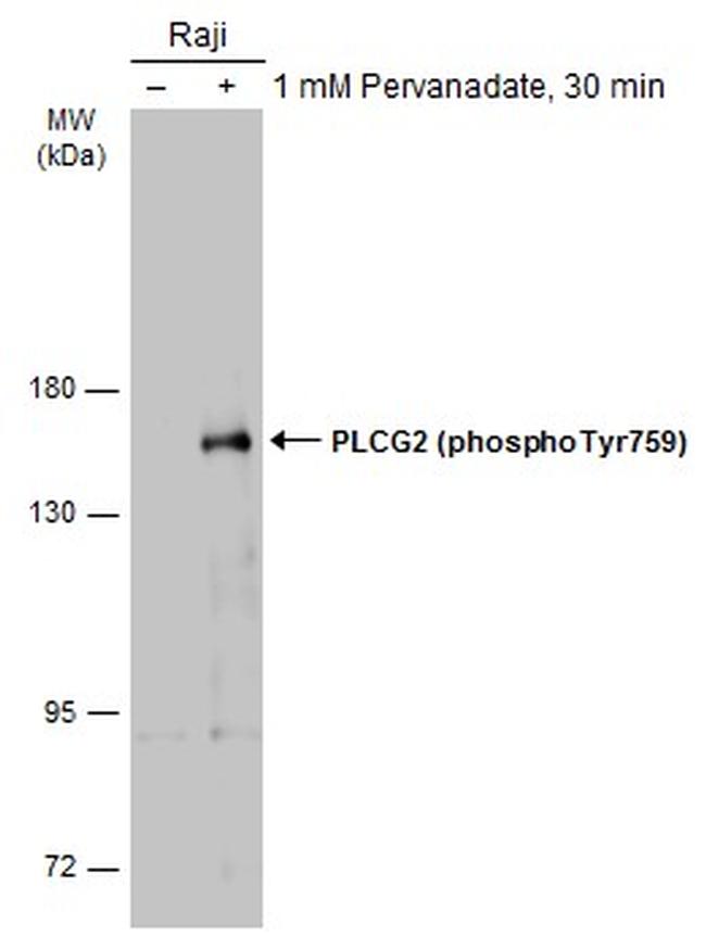 Phospho-PLCG2 (Tyr759) Antibody in Western Blot (WB)