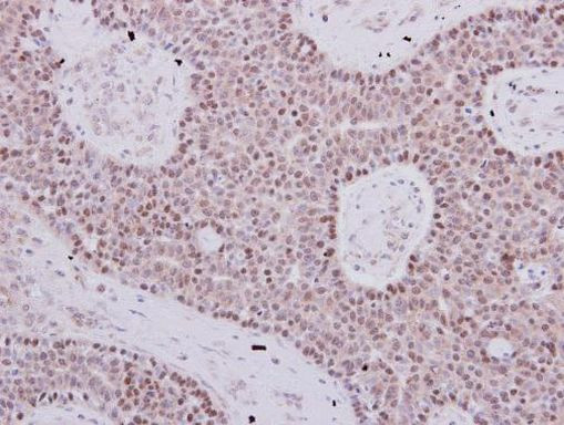 POLB Antibody in Immunohistochemistry (Paraffin) (IHC (P))