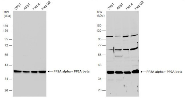 PP2A alpha/beta Antibody in Western Blot (WB)