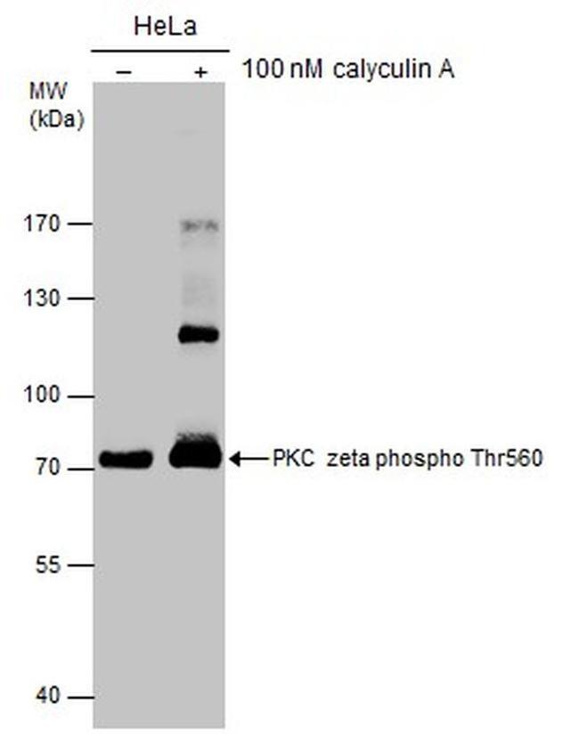 Phospho-PKC zeta (Thr560) Antibody in Western Blot (WB)
