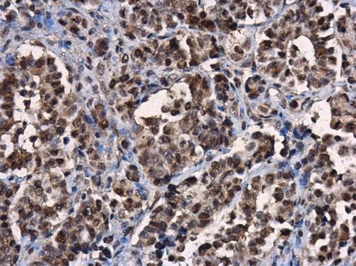 ERK2 Antibody in Immunohistochemistry (Paraffin) (IHC (P))