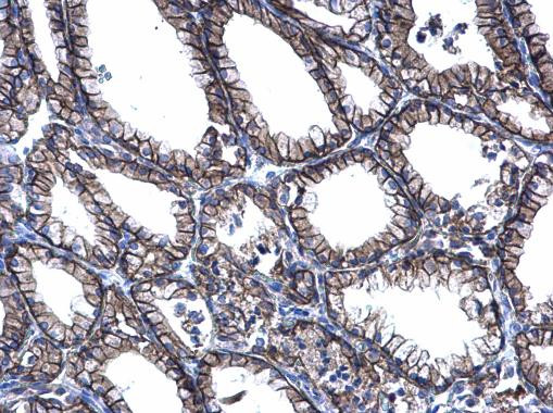 PRRG2 Antibody in Immunohistochemistry (Paraffin) (IHC (P))