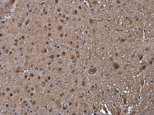 PSMB1 Antibody in Immunohistochemistry (Paraffin) (IHC (P))
