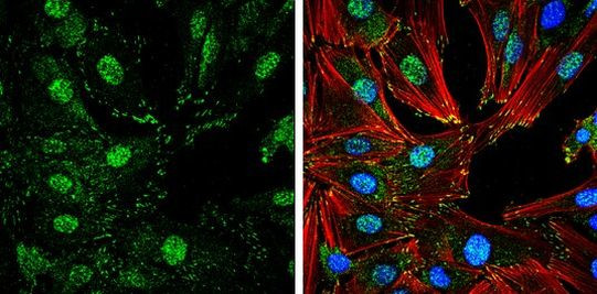 Phospho-FAK (Tyr407) Antibody in Immunocytochemistry (ICC/IF)