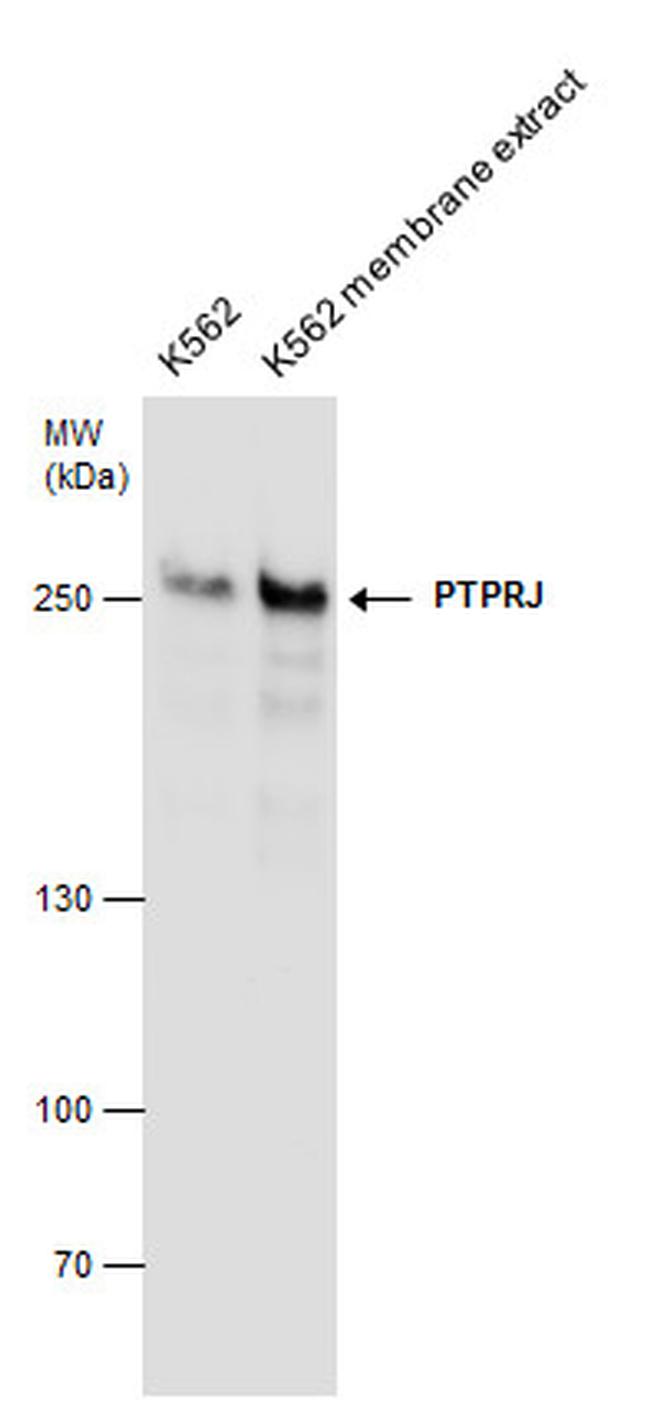CD148 Antibody in Western Blot (WB)